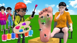 Scary Teacher 3D vs Squid Game Feet Treatment or Error 5 Time Challenge [upl. by Adnilrem627]