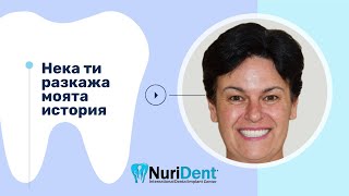 Екстракция на всички зъби и незабавно незабавно поставяне на зъбни импланти [upl. by Nap]