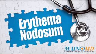 Erythema Nodosum ¦ Treatment and Symptoms [upl. by Auqinom357]