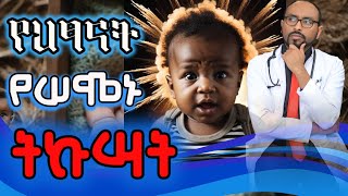 ጨቅላ ህፃናት ላይ በትኩሳት የሚመጣ ራስ መሳት እና ማንቀጥቀጥ  baby fever amp Febrile Seizure  Dr Fasil [upl. by Kloman]