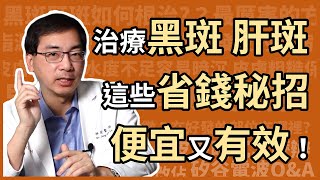 治療黑斑、肝斑，有哪些省錢又有效，高CP值的方法？醫美里長林政賢醫師大揭密！ [upl. by Graner223]