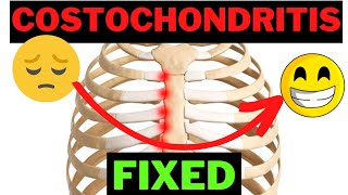 GUIDE TO UNDERSTANDING COSTOCHONDRITIS HEALING PROCESS [upl. by Assirt]