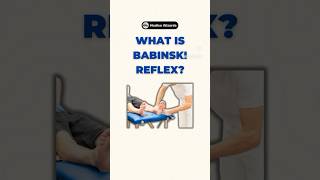 Understanding the Babinski Reflex A key neurological exam 🧠 Subscribe for more medical tips [upl. by Ilak]