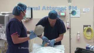 Vortex in Action Pt 2 Elective Intubation in OT [upl. by Anertak352]