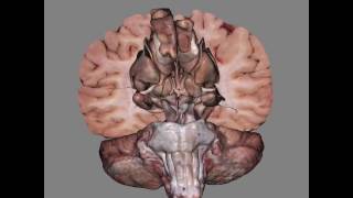 3D View Of Dissected Brain [upl. by Noremac]