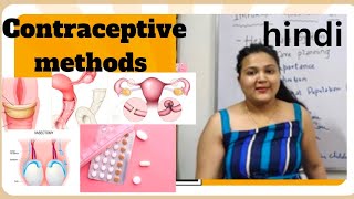 contraceptive methods  temporary permanent explanation in hindi for all medical students [upl. by Alrzc729]