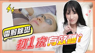 雷射「除斑」打1次就有效嗎？雀斑、曬斑、肝斑，雷射效果大不同？ [upl. by Edwin]