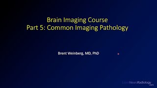 Brain imaging course – 5 – Common imaging pathology [upl. by Anirtap]