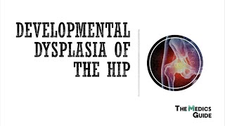 Developmental Dysplasia of the Hip [upl. by Adnolahs]