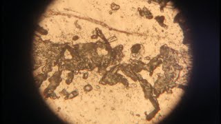 Metallographic microscope observation of intergranular corrosion test of gold phase [upl. by Iatnahs]