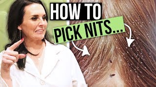 How to Remove Head Lice Eggs  Nit and Lice Picking [upl. by Roselane]