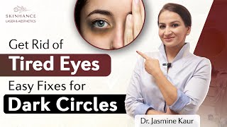 Dark circles under eyes  Get rid of dark circles  Skinhance Clinic [upl. by Aufa426]