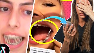 🧨Dentista REACCIONA a VIRALES de TIKTOK y te explica COSITAS MUY UTILES del proceso de Brackets 🤫 [upl. by Nedi915]