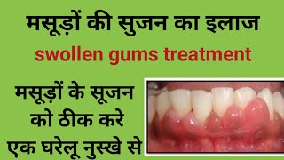 मसूड़ों की सुजन का इलाज swollen gums treatment मसूड़ों के सुजन को ठीक करे एक घरेलू नुस्खे से [upl. by Nairbal]