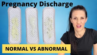 Pregnancy Discharge  Vaginal Discharge During Pregnancy  WHAT TO KNOW [upl. by Atilemrac]