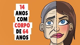 Tenho 14 anos mas minha idade biológica é de 63 Agora eu estou perdendo meus dentes [upl. by Anauqahs]