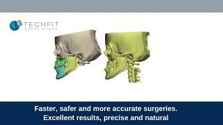 Orthognathic digital Planning solution  Techfit Digital Surgery [upl. by Nylareg263]