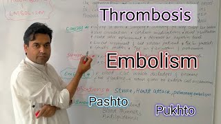 Thrombosis and Embolism  Biology class 11  Dr Mushtaq Pashto Lectures [upl. by Aicatsue]