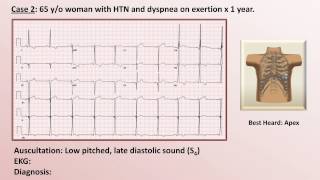 EKG and Heart Murmur Review  Part 1 [upl. by Aliban116]