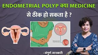 Endometrial Polyp बिना सर्क्याजरी के क्या दवाइयों से ठीक हो सकता है [upl. by Ellak]