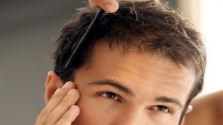 How to Treat Balding Hair  Thinning Hair [upl. by Ydnec]