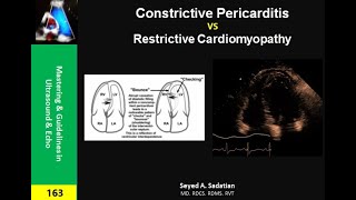 Constrictive Pericarditis vs Restrictive Cardiomyopathy [upl. by Gershon]