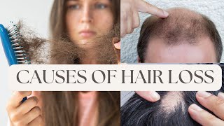 Why Am I Losing My Hair Exploring Common Causes of Hair Loss  Dr Kim Detollenaere [upl. by Aihsel295]