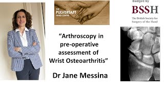 Arthroscopy in preoperative assessment of wrist osteoarthritis by Dr Jane Messina [upl. by Loziram608]