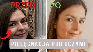 Jak usunąć cienie pod oczami  TANIE rozwiązania [upl. by Andree54]