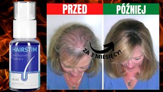 HAIRSTIM OPINIE Piękno Włosów ⚠️  Hairstim Recenzja  Hairstim [upl. by Johnathon]