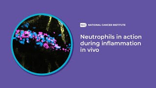 Neutrophils in action during inflammation in vivo [upl. by Franciska242]