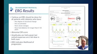 RETeval Optometric Case ERG Alters Followup Schedule and Education by Nate Lighthizer OD [upl. by Leahcin]