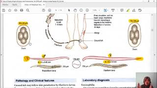 NEMATODA USUS 6 Ancylostoma duodenale [upl. by Earized]