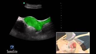 How To Female Pelvis Ultrasound Exam 3D Video [upl. by Netram]