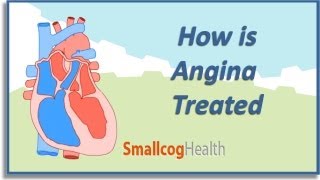 How is Angina Treated [upl. by Blakely]