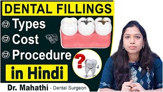 What are Dental Fillings and Its Types  Tooth Filling Procedure in Hindi Eledent Dental Hospitals [upl. by Guillermo]