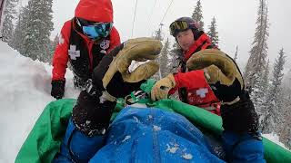 Long form What its like to break your leg skiing and be saved by ski patrol [upl. by Rebhun509]