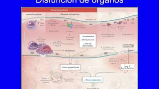 Fisiopatología de la Sepsis [upl. by Zumstein591]