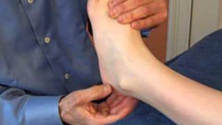 Calcaneofibular Ligament Fascial Separation [upl. by Stephani]