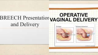 Singleton Breech Delivery and Operative Vaginal Delivery  Dr D Estuart [upl. by Roselin]