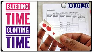 BT CT Test  Bleeding Time AND Clotting Time Coagulation Time Blood Test [upl. by Dunston53]