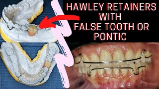 Hawley RETAINERS with FALSE TOOTH or Pontic  PHILIPPINES [upl. by Gil2]