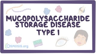 Mucopolysaccharide Storage Disease Type I Hurler HurlerScheie and Scheie syndromes [upl. by Yrome]