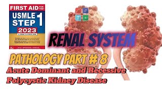 Polycystic Kidney DiseaseAutosomal Dominant and Recessive for USMLE step 1pathology 9UrduHindi [upl. by Emie]