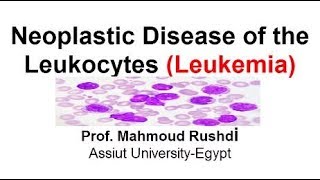 Neoplastic Disease of the Leukocytes  Leukemia Arabic Lecture [upl. by Aurita]