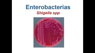 Shigella [upl. by Atnes]