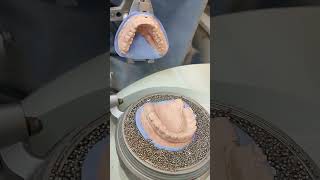 FÉRULA DE BRUXISMO nuriadental protesisdental esteticadental boca protesisdentales [upl. by Ruyle733]