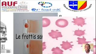 MORPHOLOGIE EN HEMATOLOGIE EPISODE 2 [upl. by Weidar]