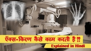 XRays Explained in very Simple language HINDI [upl. by Nylodnewg554]