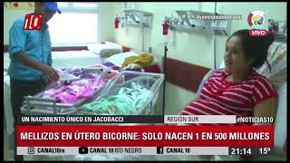 Noticias10  Nacimiento en útero bicorne en Jacobacci [upl. by Pol]